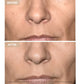 Mască Facială LED Anti-Aging Megatot, Lumină Roșie și Infraroșie