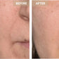 Mască Facială LED Anti-Aging Megatot, Lumină Roșie și Infraroșie